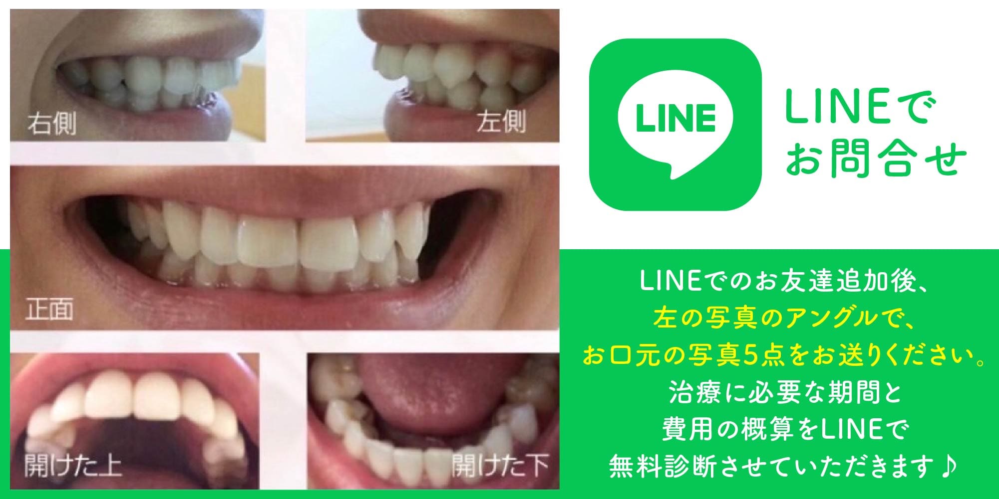 ラ・ブージュデンタルクリニックのLINE相談